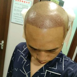 发际线分享社区