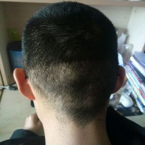发际线分享社区