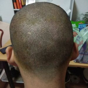 发际线分享社区