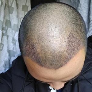 发际线分享社区