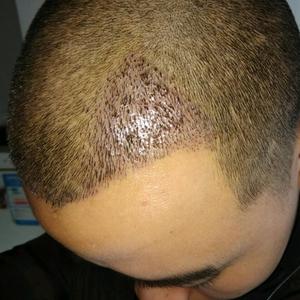 发际线分享社区