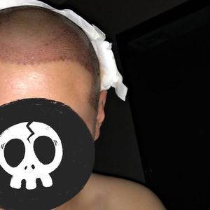 发际线分享社区