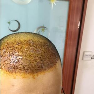 发际线分享社区