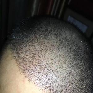 发际线分享社区