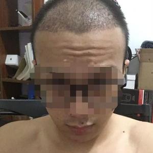 发际线分享社区