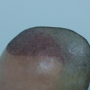 发际线分享社区