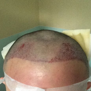 发际线分享社区