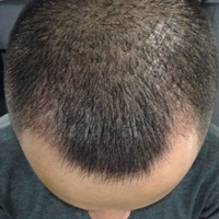 <font color="red">稀少加密</font>用戶圖片