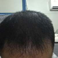 <font color="red">稀少加密</font>用戶圖片