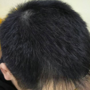 发际线分享社区