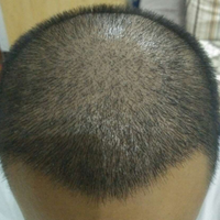 <font color="red">稀少加密</font>用戶圖片