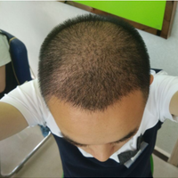 <font color="red">稀少加密</font>用戶圖片