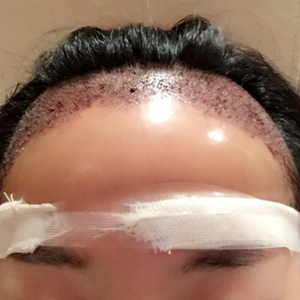 发际线分享社区