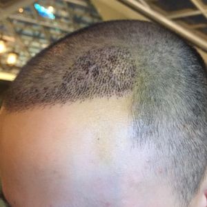 发际线分享社区