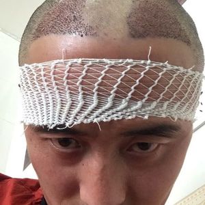 发际线分享社区