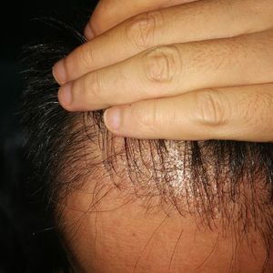 发际线分享社区
