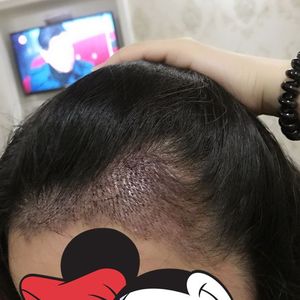发际线分享社区