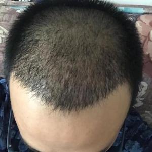 发际线分享社区