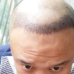 发际线分享社区