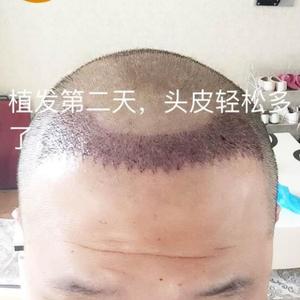 发际线分享社区