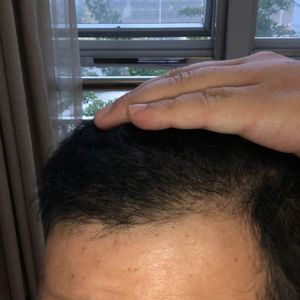 发际线分享社区