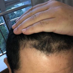发际线分享社区