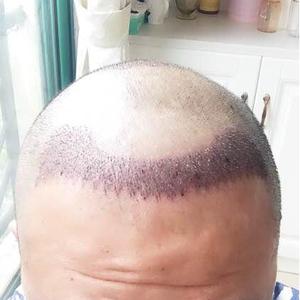 发际线分享社区