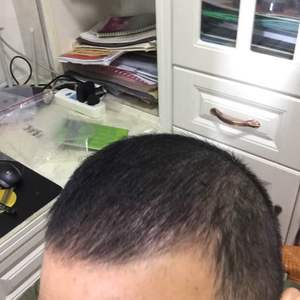 发际线分享社区