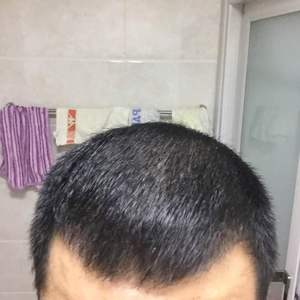 发际线分享社区