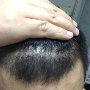 发际线分享社区