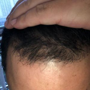 发际线分享社区
