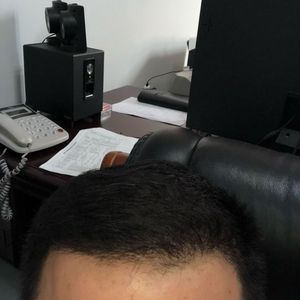 发际线分享社区