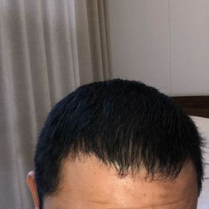 发际线分享社区
