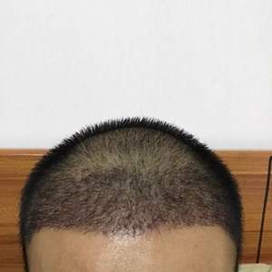 发际线分享社区