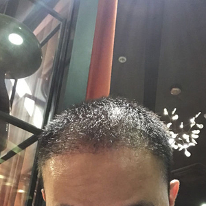 发际线分享社区