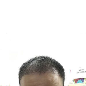 发际线分享社区
