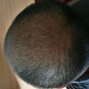 发际线分享社区