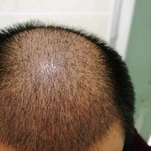 发际线分享社区