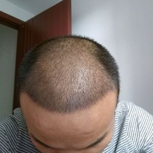 发际线分享社区