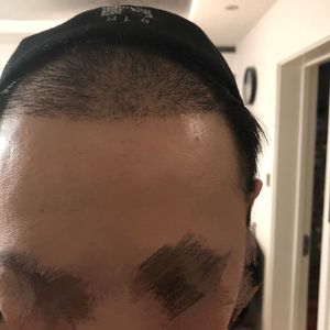 发际线分享社区