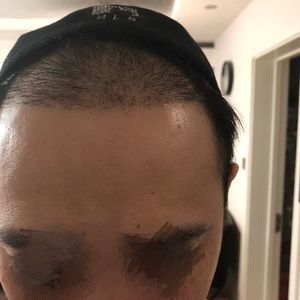 发际线分享社区