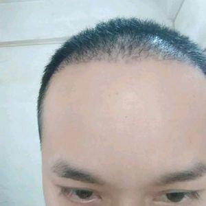 发际线分享社区