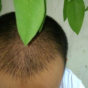 发际线分享社区