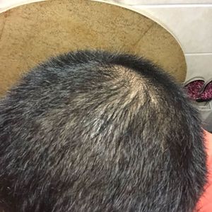 发际线分享社区