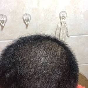 发际线分享社区