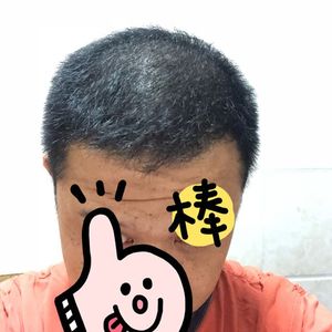 发际线分享社区