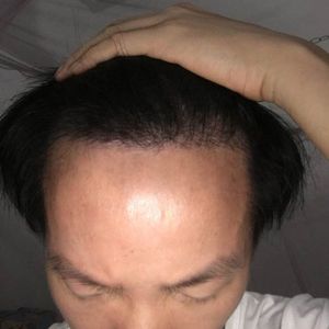 发际线分享社区