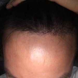发际线分享社区