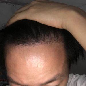 发际线分享社区