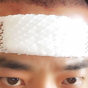 发际线分享社区
